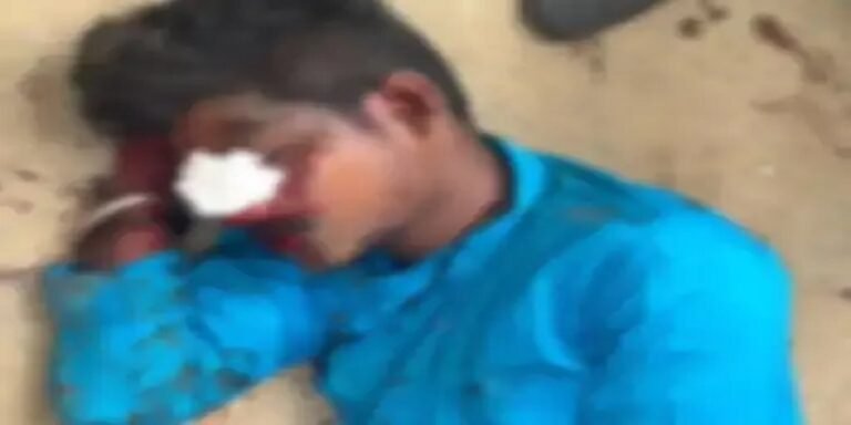 कोरबा-सक्ति मार्ग पर हादसा: स्कूल बस की टक्कर से बाइक सवार घायल, चालक फरार