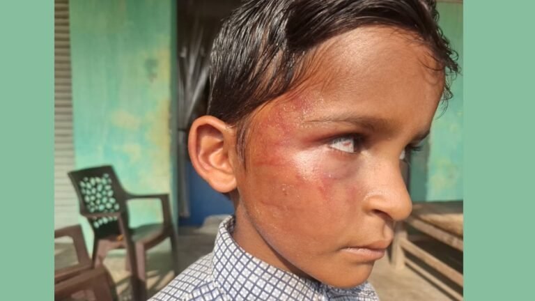 गिनती न सुन पाने पर शिक्षक ने छात्र को मारा, गंभीर चोटें आईं, आंख में खून