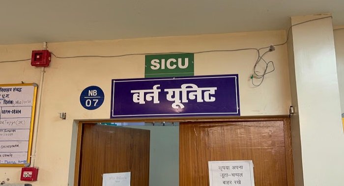 प्यार बना दुश्मनी की वजह: प्रेमिका के भाई ने प्रेमी को जिंदा जलाने की कोशिश, तालाब में कूदकर बची जान