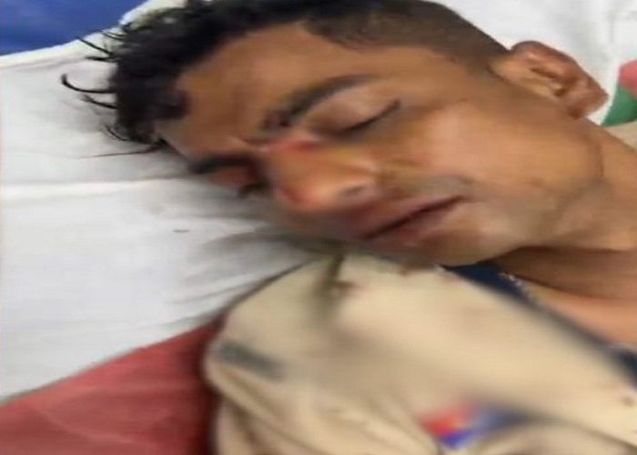 बिलासपुर में पुलिसकर्मी पर हमला: डायल-112 आरक्षक को डंडे से पीटा, आरोपी गिरफ्तार
